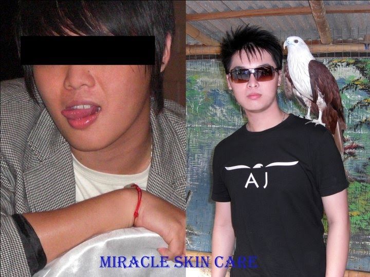beforeaftersamy_zpsf10bdfe6.jpg