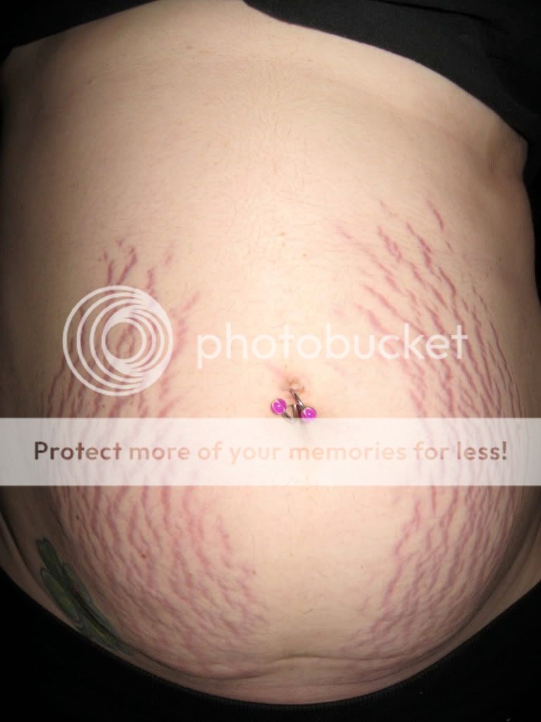 stomach tattoos ruined after pregnancy